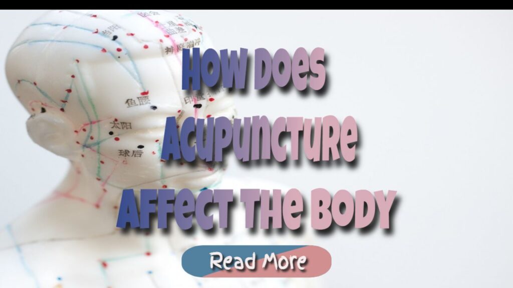 What Conditions May Benefit From Acupuncture?